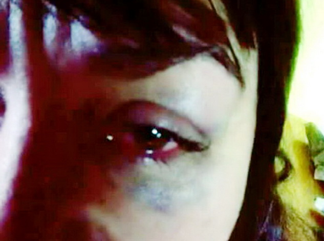 golpeada1