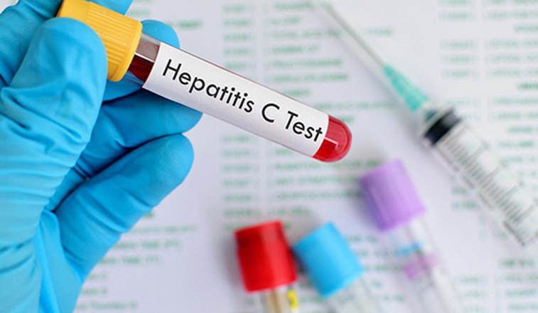 hepatitis